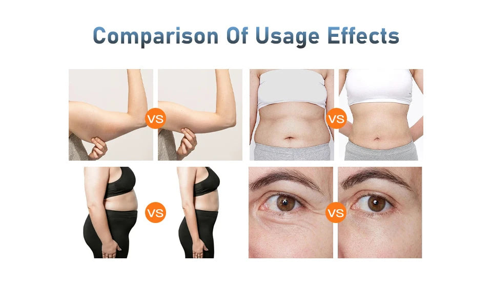4IN1 Vacuum 40K Body Cavitation Fat Burner - Littles Collection