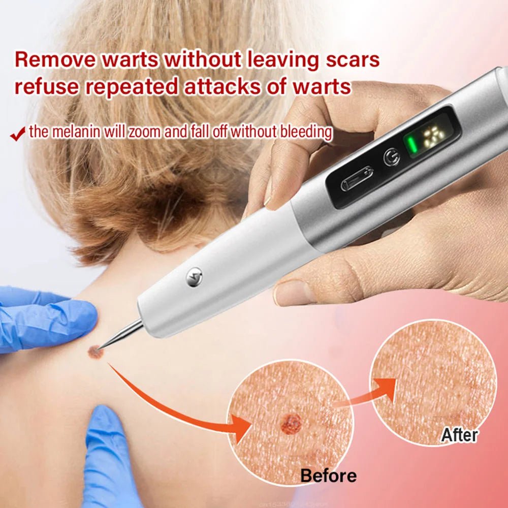 Sweep_Spot_Pen_for_Acne_Spot_Remover_women_fashion - littlescollection