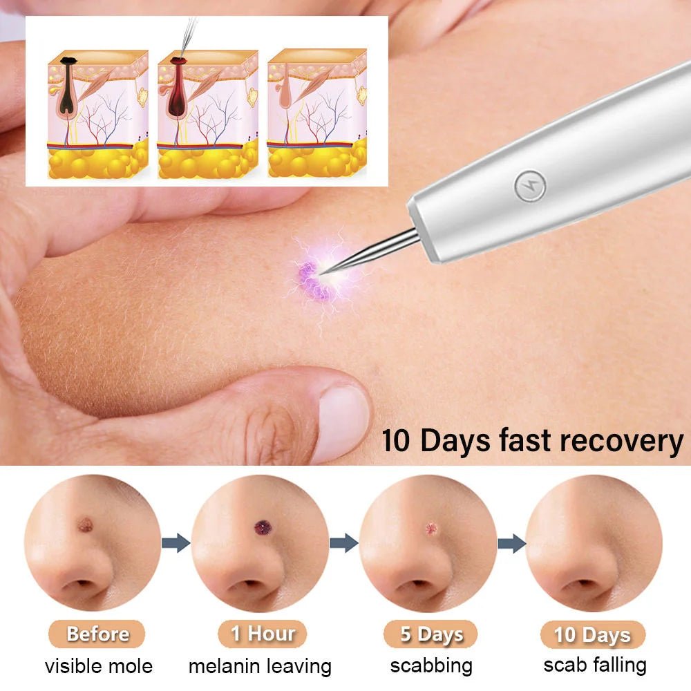 Sweep_Spot_Pen_for_Acne_Spot_Remover_women_fashion - littlescollection