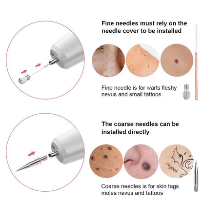 Sweep_Spot_Pen_for_Acne_Spot_Remover_women_fashion - littlescollection